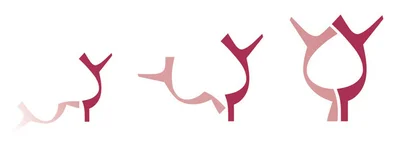 Logo Entstehung Die Entstehung des Logos Stiftung Liebenau